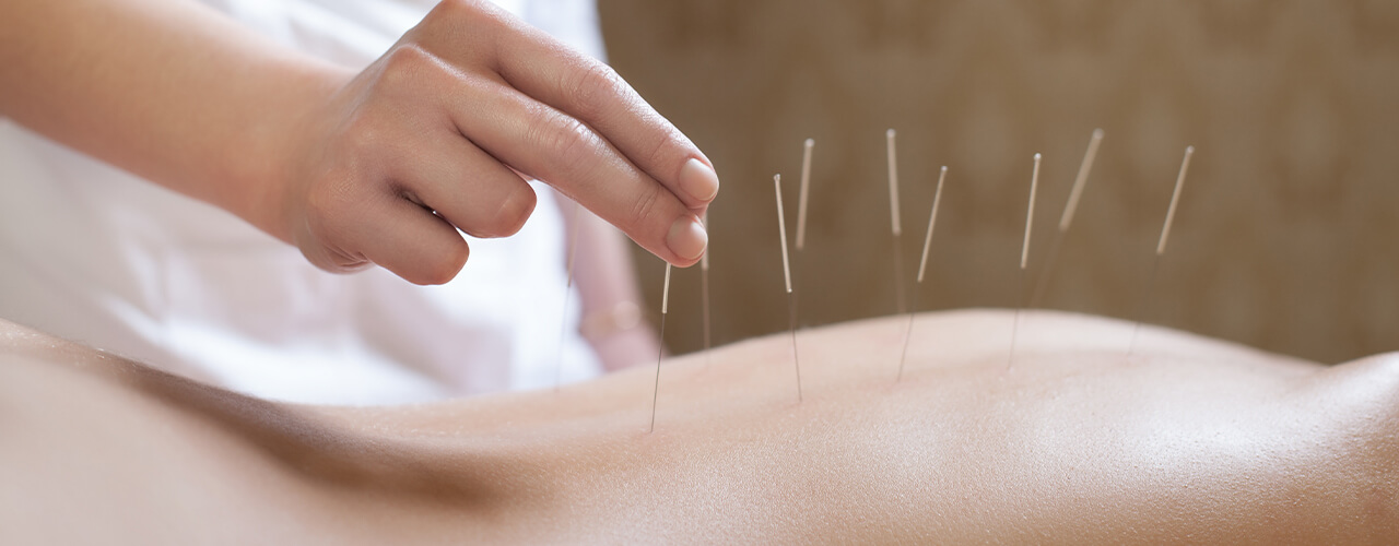 Acupuncture Bedford, Timberlea & Dartmouth, NS